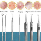8pcs skin care extraction tool kit, blackhead remover kit, acne removal tool set, professional pimple extractor, stainless steel acne tools, beauty salon extraction kit