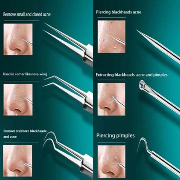 8pcs skin care extraction tool kit, blackhead remover kit, acne removal tool set, professional pimple extractor, stainless steel acne tools, beauty salon extraction kit
