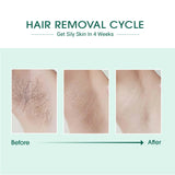 Before and after hair removal cycle showing reduced hair growth on skin.