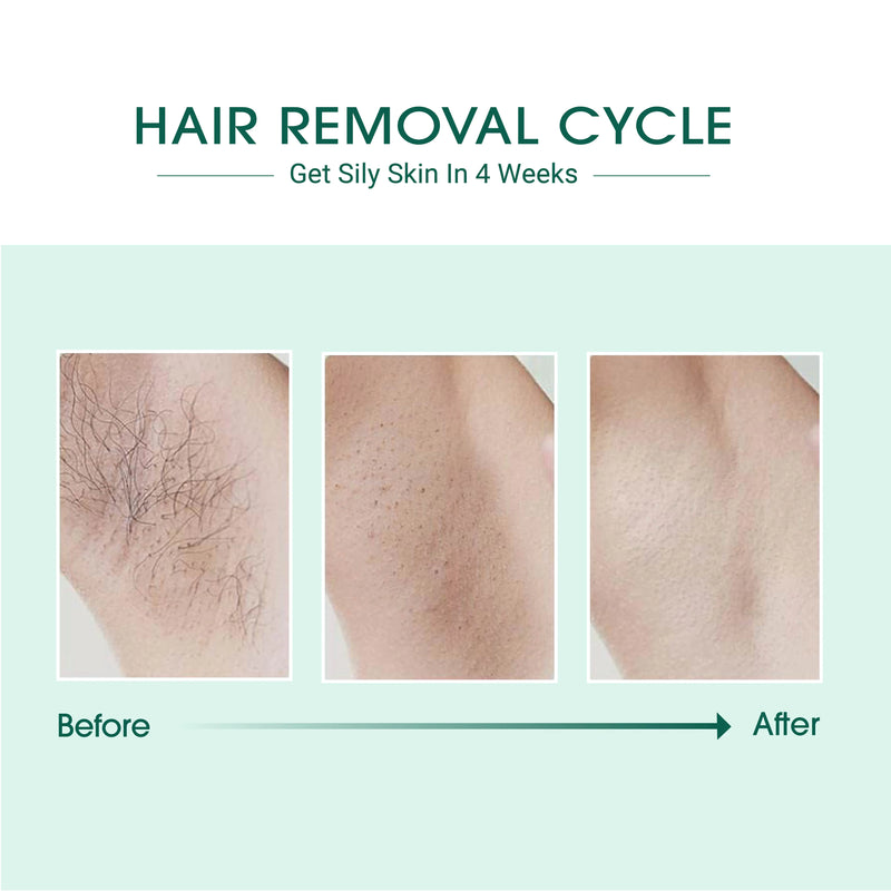 Before and after hair removal cycle showing reduced hair growth on skin.